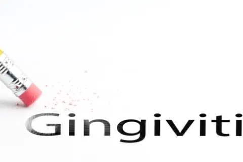 ESSENTIAL INFORMATION ABOUT GINGIVITIS