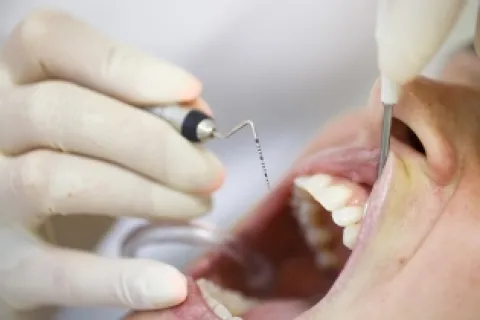 TYPES OF PERIODONTITIS