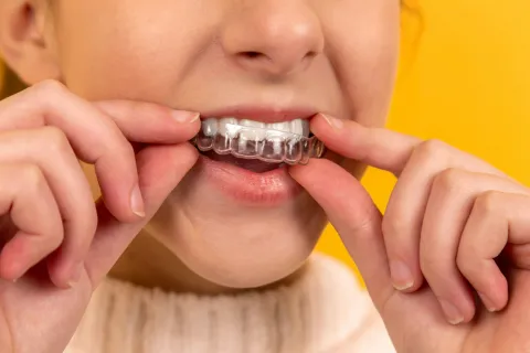 Person placing a clear dental aligner on their upper teeth against a yellow background.
