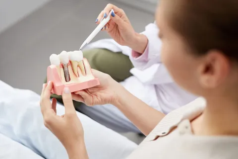 Dental professional demonstrating dental implants using a model during a patient consultation.