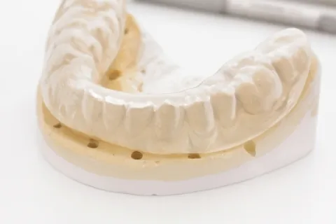 EXAMINING THE CAUSES AND TREATMENTS OF BRUXISM