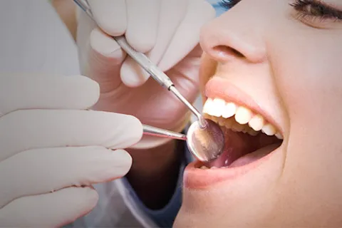 Close-up of a dental checkup showing dentist's hands with tools examining a patient's teeth and mouth.