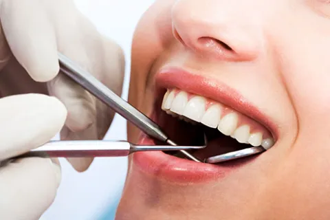 Close-up of a dental checkup with dentist using tools to examine a patient's teeth and mouth.