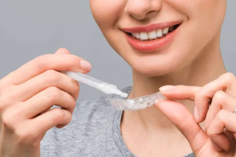 Woman demonstrating dental care with clear aligners and teeth whitening treatment applicator.