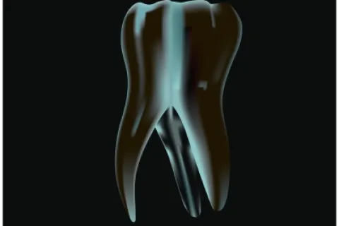 Illustration of a stylized tooth on a dark background, highlighting dental health themes.