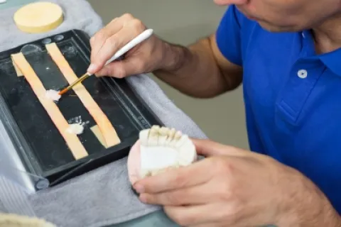 Dental technician applying material to molds for creating dental prosthetics in a lab setting.