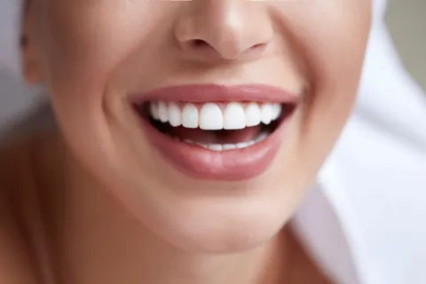 Close-up of a woman's smile showcasing bright white teeth and soft lips, exuding confidence and health.