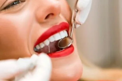Everything You Need to Know About Cavities