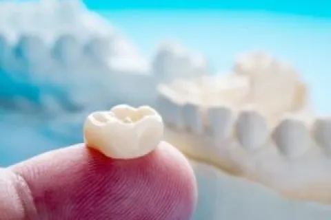 What are Dental Crowns