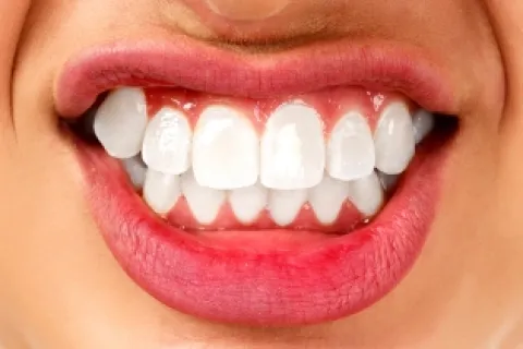 FINDING THE RIGHT TREATMENT FOR BRUXISM SYMPTOMS