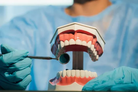 Effective Treatment for Gum Recession: Solutions and Insights