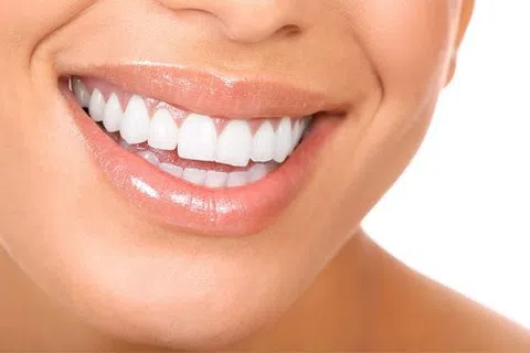 Close-up of a smiling person showing clean, white teeth and glossy lips against a white background