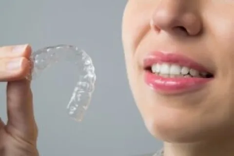 REASONS YOUNG PATIENTS SHOULD CONSIDER INVISALIGN