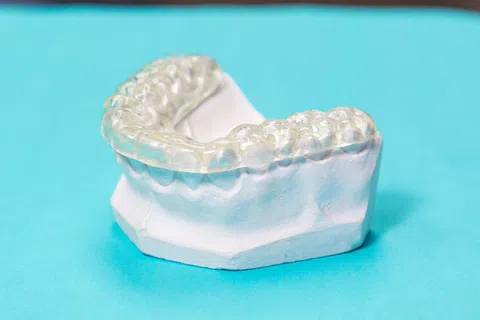 Clear dental aligner placed on a white plaster dental mold on a blue background