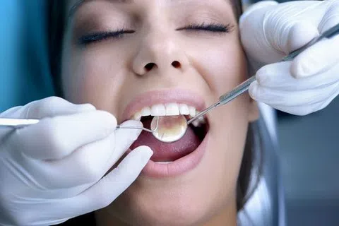 Close-up of a dental checkup showing a patient with open mouth and dentist's gloved hands using dental tools