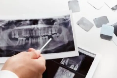 COMMON TREATMENTS FOR GUM AND JAW ISSUES