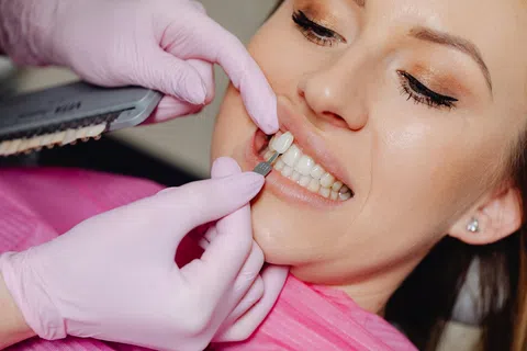 Dentist matching dental veneer shade to patient's teeth using a shade guide tool during consultation.