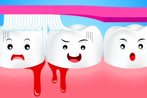 Causes of Bleeding Gums and Gum Disease