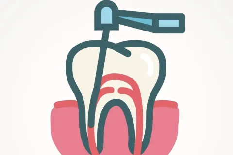 Uncover the Truth About Root Canal Treatment