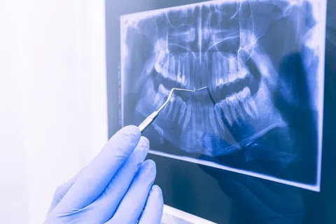 The Rise of AI in Dentistry: How Technology is Shaping Your Dental Experience in 2025