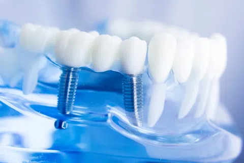 Same-Day Care: How Technology is Revolutionizing Restorative Dentistry