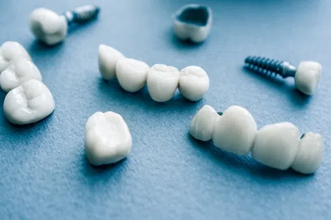 Are Dental Implants Right for You?