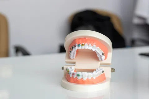 Dental model showing teeth with colorful braces on upper and lower jaw on white surface.