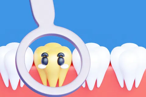 Close-up of a sad yellow tooth with decay among healthy white teeth under dental magnifying glass.