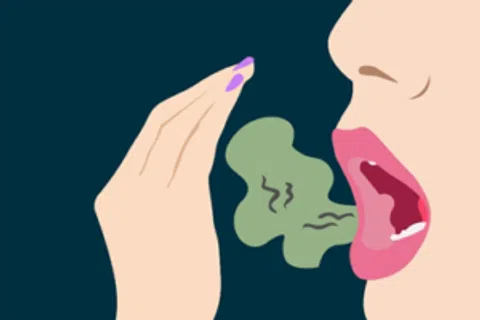 Roanoke Dentist | How to Beat Bad Breath