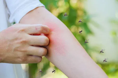 Person scratching red, itchy arm surrounded by mosquitoes in a green outdoor setting.