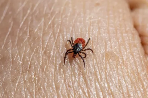 Close-up of a black and red tick crawling on human skin showing detailed texture and body of the parasite
