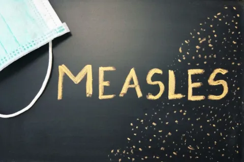 CDC and HHS Provide Update about the Measles Outbreak