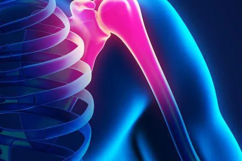 Questions to Ask Your Orthopedic Surgeon Before Shoulder Surgery