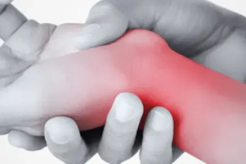 De Quervain’s Syndrome