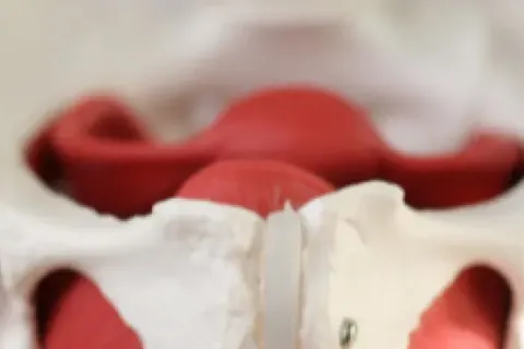 Osteoarthritis of the Hip: Symptoms, Causes, and Treatment Options