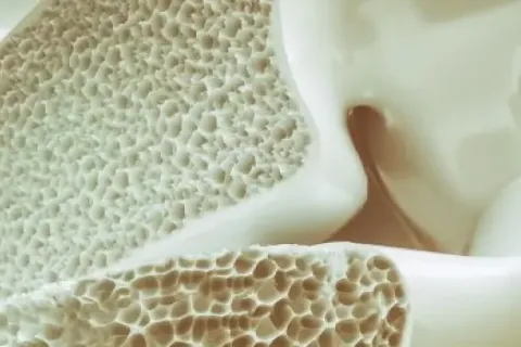 Reduce Your Risk of Fractures with Prolia