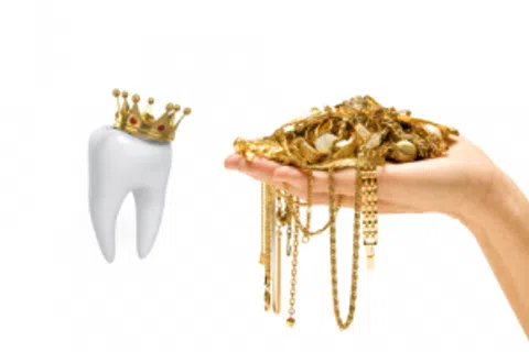 Popular “Crowns” In History