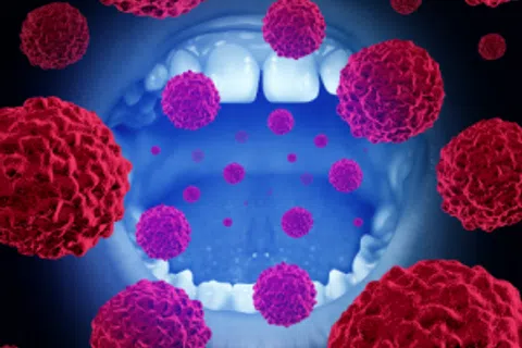 Oral & Oropharyngeal Cancers