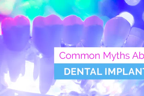 Common Dental Implant Myths
