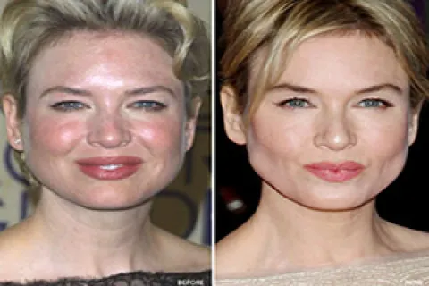 Renee Zellweger, Renee Zellweger are posing for a picture