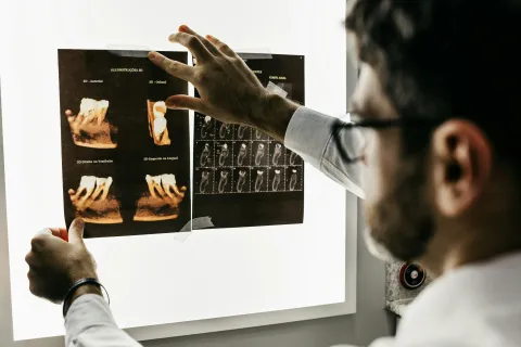 Doctor examining dental X-rays with detailed tooth and jaw images on lightbox in clinical setting