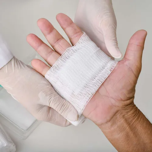 Medical professional wearing gloves applies a sterile gauze pad to a patient's palm injury for wound care.