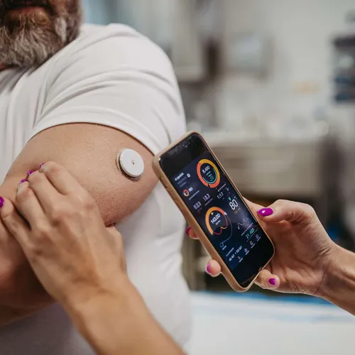 Person monitoring health data on smartphone linked to wearable glucose sensor on arm.