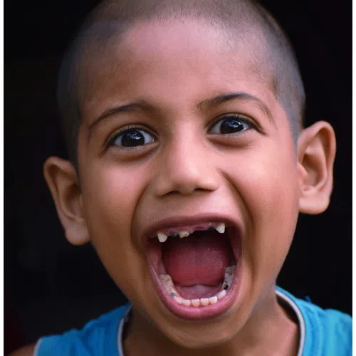 Close-up of a joyful boy with a shaved head wearing a blue shirt and wide open mouth showing teeth.