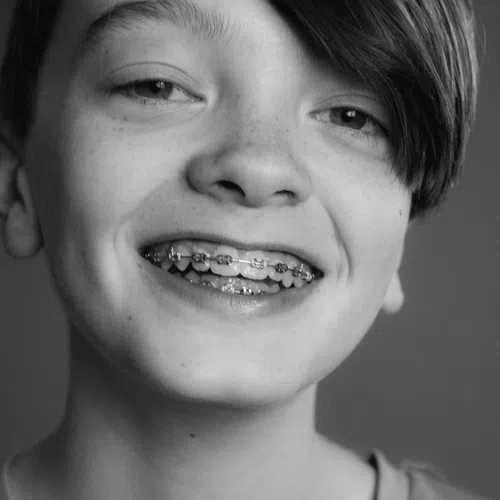 Black and white close-up of a smiling teenager with braces and side-swept hair