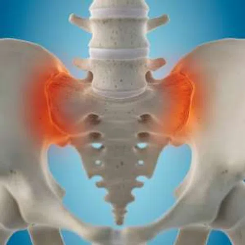 Highlighted sacroiliac joints in the human pelvis showing inflammation or pain areas in red on a blue background