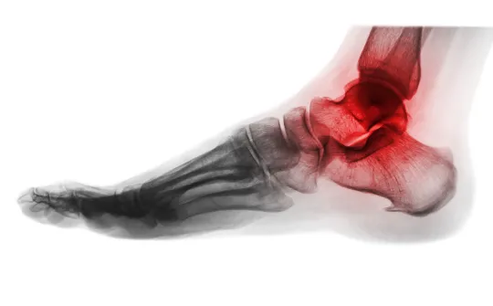 a close-up of a foot