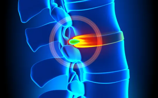 a blue and white x-ray