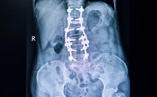 a close-up of a human body