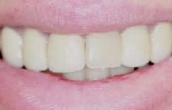 Close-up of a smiling mouth showing natural white teeth and pink lips, emphasizing oral health.